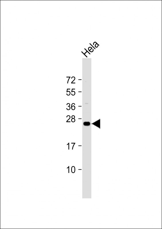 Rabbit Polyclonal Antibody to ERAS (N-term) (A28)