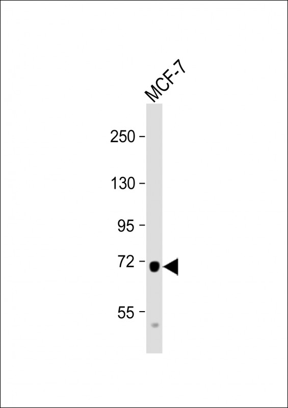Rabbit Polyclonal Antibody to PDZK1
