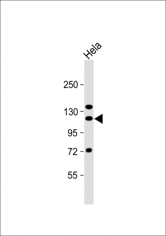 Rabbit Polyclonal Antibody to SND1