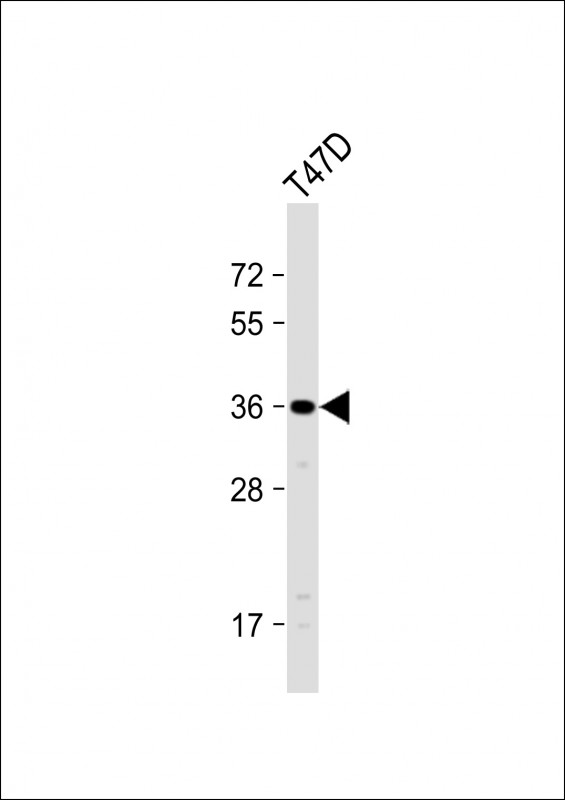 Rabbit Polyclonal Antibody to OR4D11
