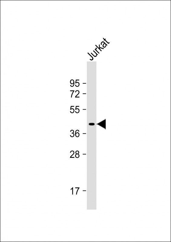 Rabbit Polyclonal Antibody to DNMT3L