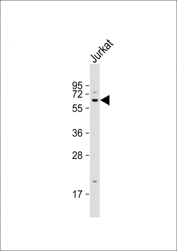 Rabbit Polyclonal Antibody to APPBP2