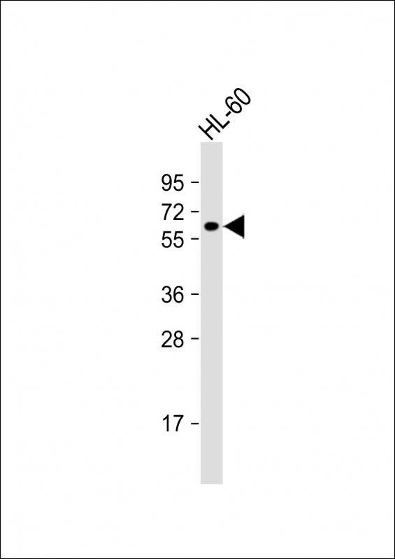 Rabbit Polyclonal Antibody to KLHL3
