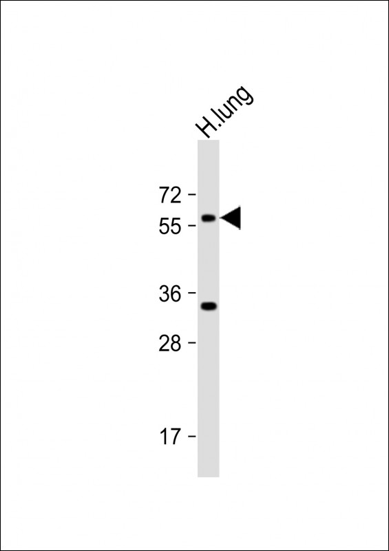 Rabbit Polyclonal Antibody to ASB2 (N-term)