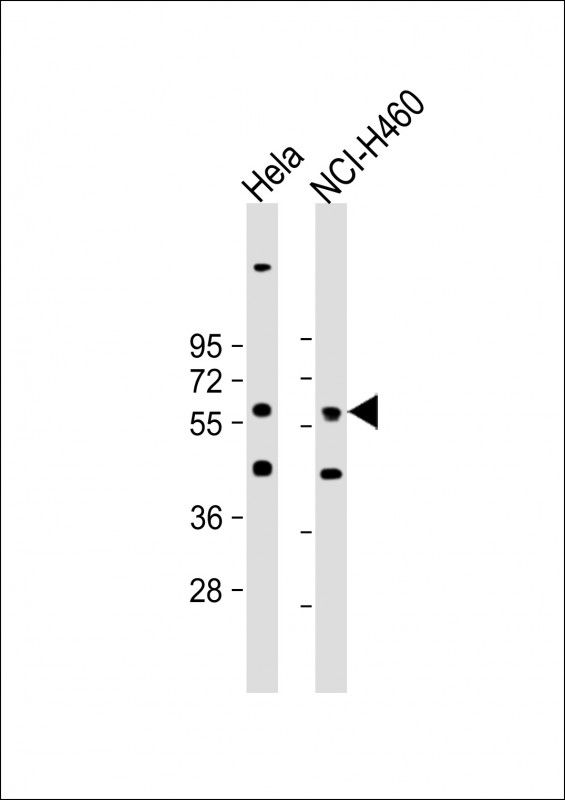 Rabbit Polyclonal Antibody to CRLF3