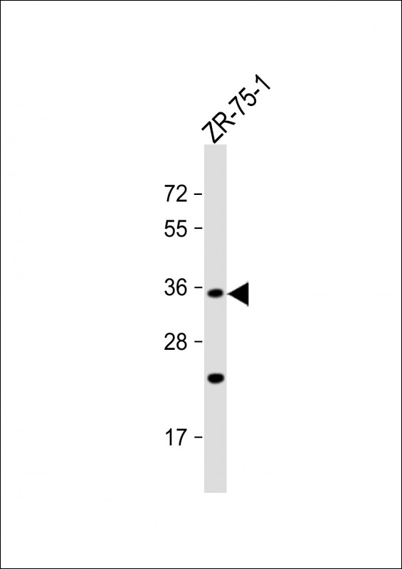 Rabbit Polyclonal Antibody to OR2L8