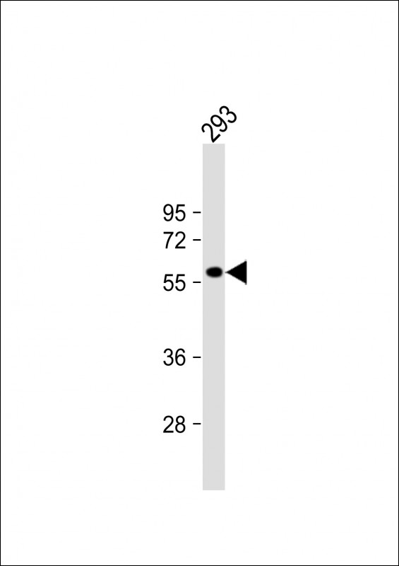 Rabbit Polyclonal Antibody to RASGEF1C (N-term)