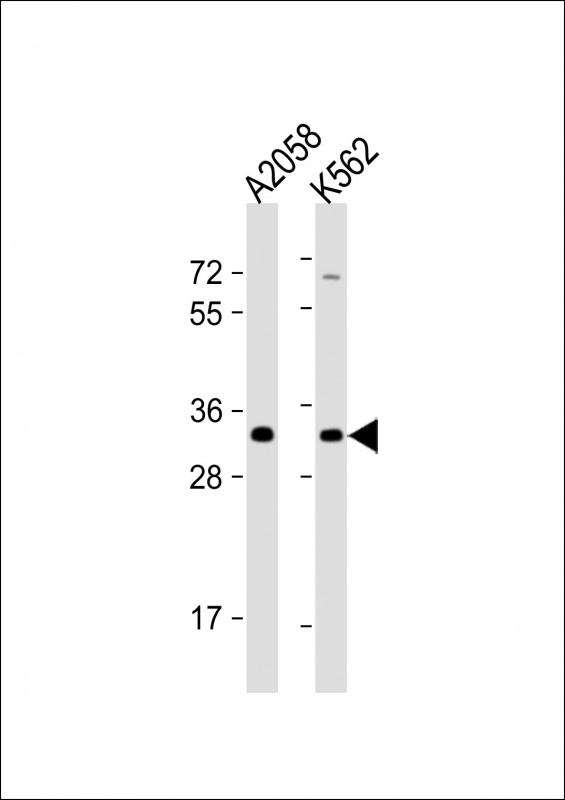 Rabbit Polyclonal Antibody to OR8J3