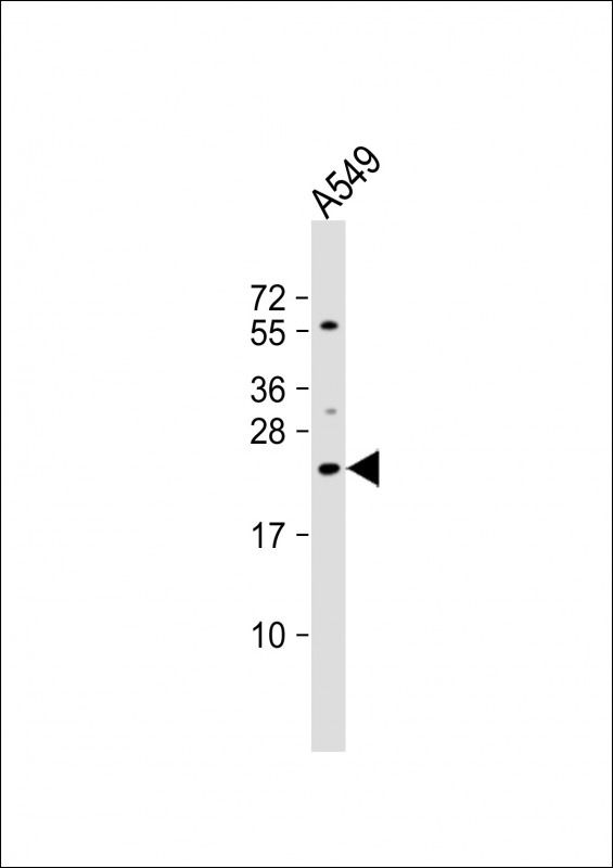 Rabbit Polyclonal Antibody to ECSCR