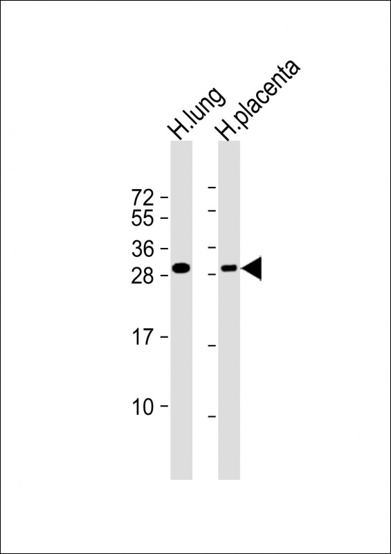 Rabbit Polyclonal Antibody to RGS19 (S24)