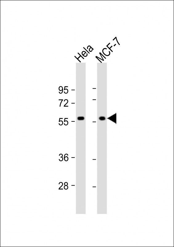 Rabbit Polyclonal Antibody to TIGD1 (N-term)