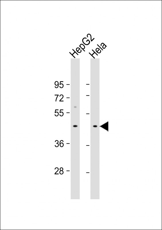Rabbit Polyclonal Antibody to GIPC3