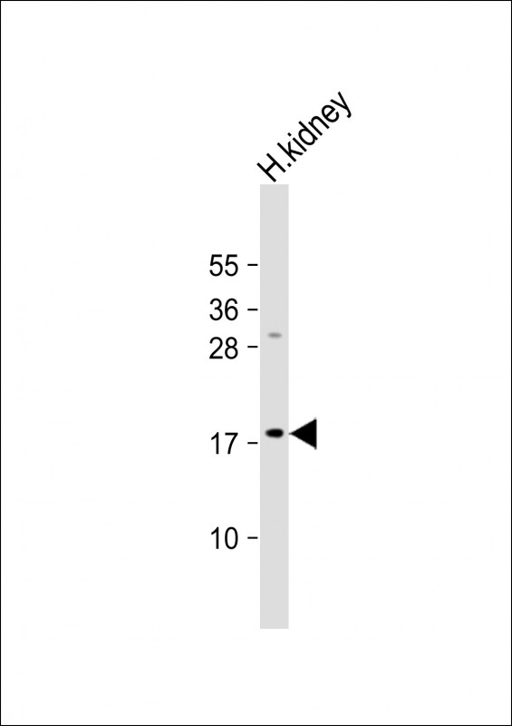 Rabbit Polyclonal Antibody to LYZL1