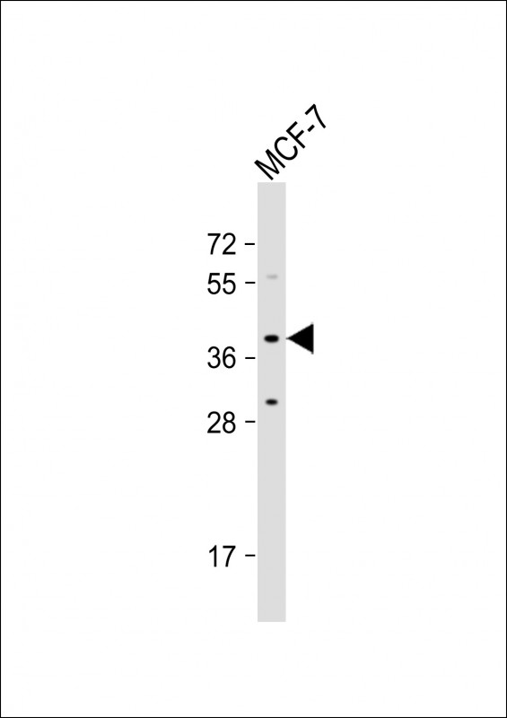 Rabbit Polyclonal Antibody to OR4X1 (N-term)