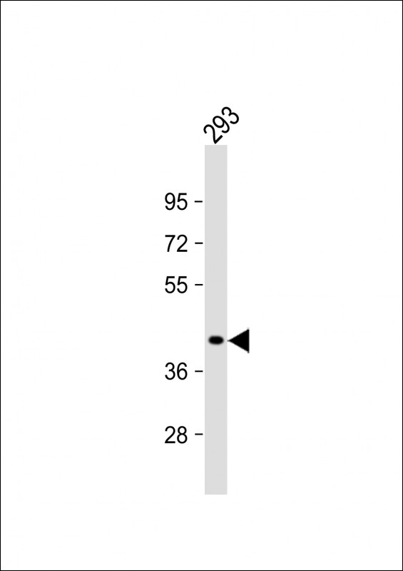 Rabbit Polyclonal Antibody to GIPC2