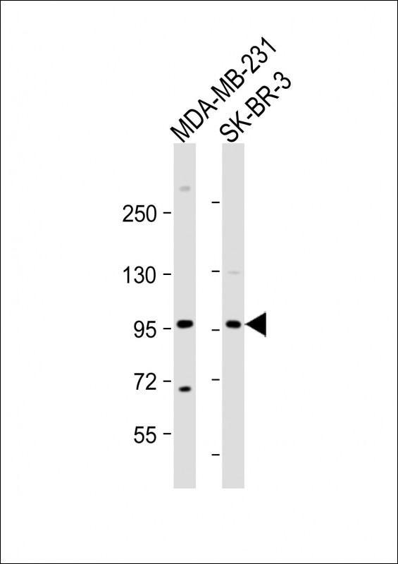 Rabbit Polyclonal Antibody to TCHHL1 (N-term)