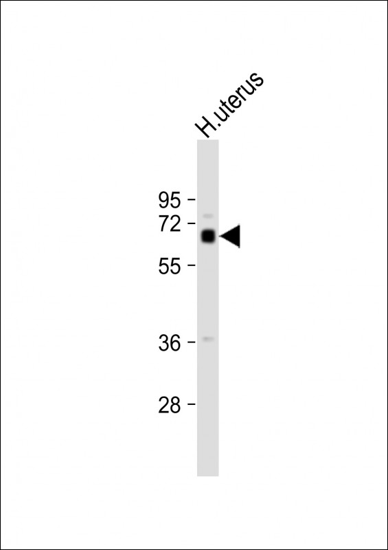 Rabbit Polyclonal Antibody to ZFP64