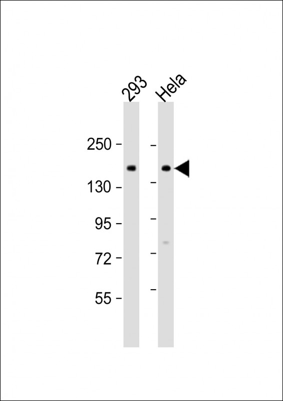 Rabbit Polyclonal Antibody to AMOT (Center S305)