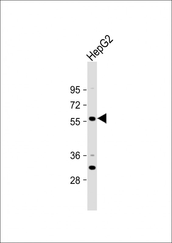 Rabbit Polyclonal Antibody to ST6GAL2(C-term)