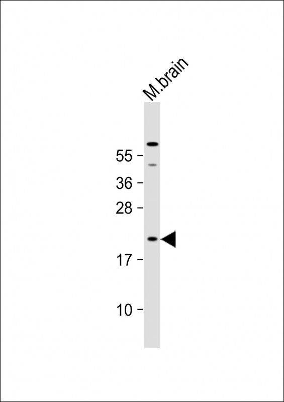 Rabbit Polyclonal Antibody to Mouse Hras1(C-term)