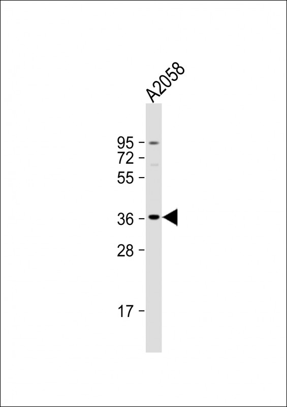 Rabbit Polyclonal Antibody to OR52J3(C-term)