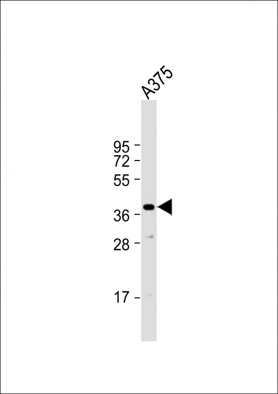 Rabbit Polyclonal Antibody to PIH1D1(Center)