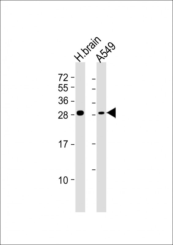 Rabbit Polyclonal Antibody to ASCL1 (Achaete-scute homolog 1) (C-term D220)
