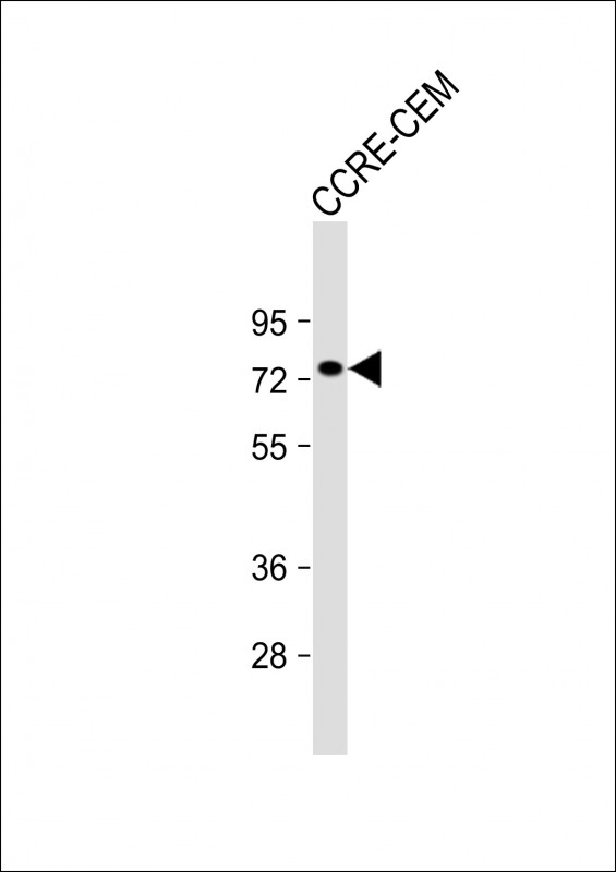 Rabbit Polyclonal Antibody to APBB2