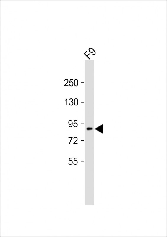 Rabbit Polyclonal Antibody to SUZ12