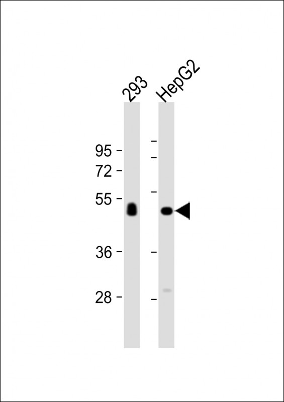 Rabbit Polyclonal Antibody to CPVL