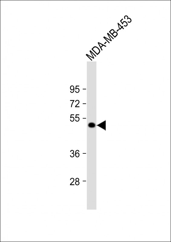 Rabbit Polyclonal Antibody to ZBTB8A