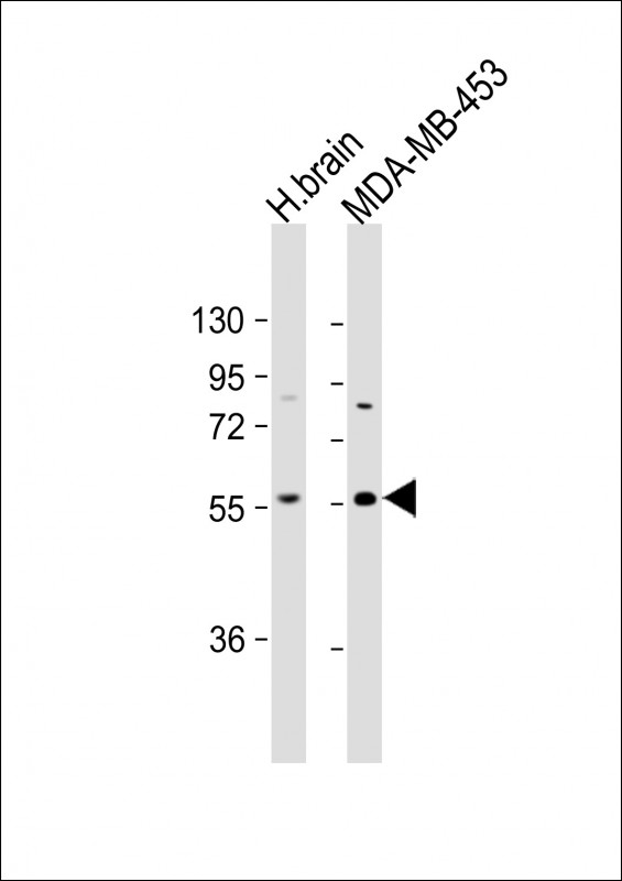 Rabbit Polyclonal Antibody to IGSF21 (N-term)