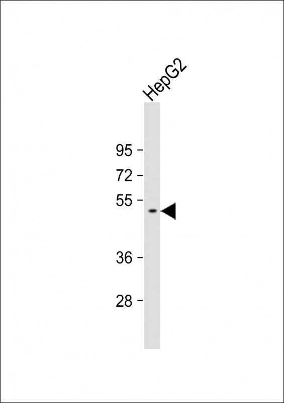 Rabbit Polyclonal Antibody to GTDC1