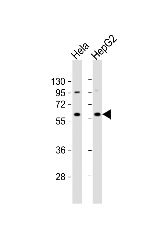 Rabbit Polyclonal Antibody to NAPRT1 (N-term)