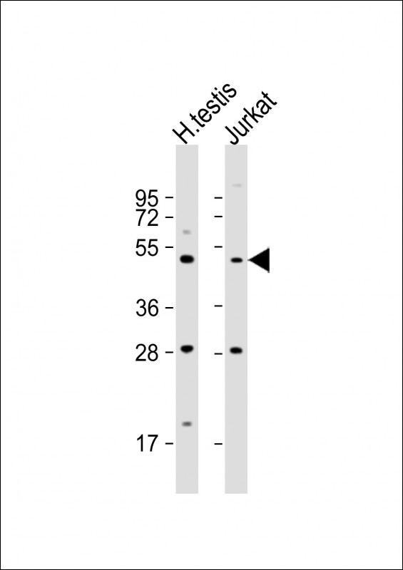 Rabbit Polyclonal Antibody to OXCT2