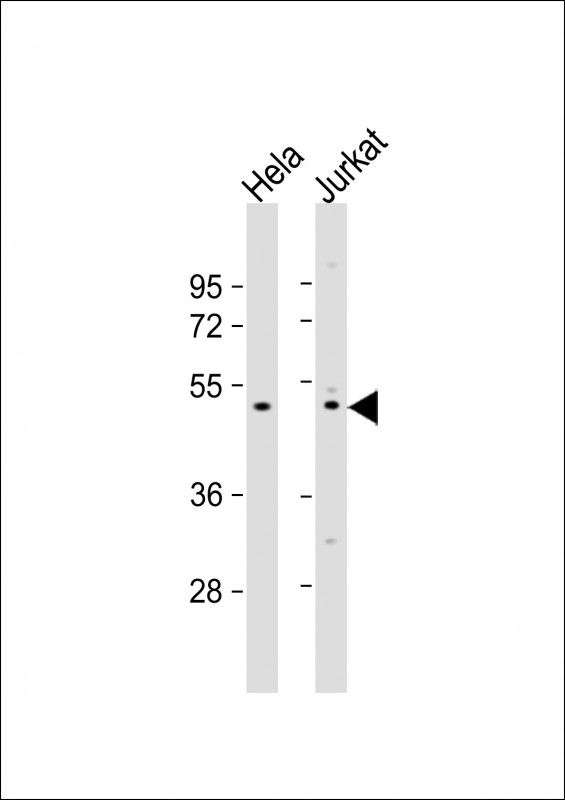 Rabbit Polyclonal Antibody to ZNF577 (N-term)