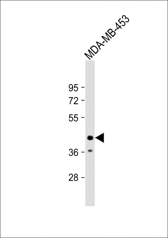 Rabbit Polyclonal Antibody to LMAN2L