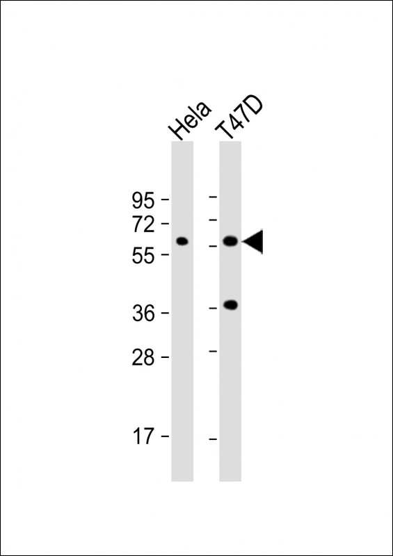 Rabbit Polyclonal Antibody to USP21 (N-term P31)