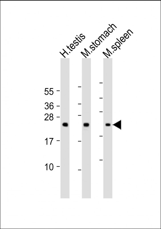 Rabbit Polyclonal Antibody to NAA40