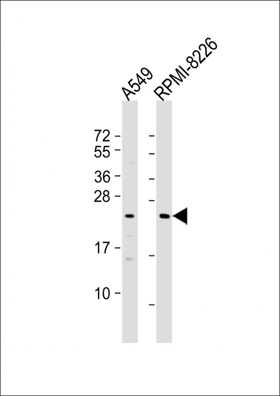 Rabbit Polyclonal Antibody to NT5M