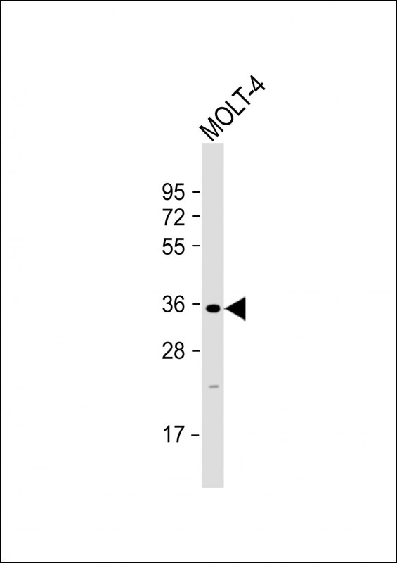 Rabbit Polyclonal Antibody to GLT6D1