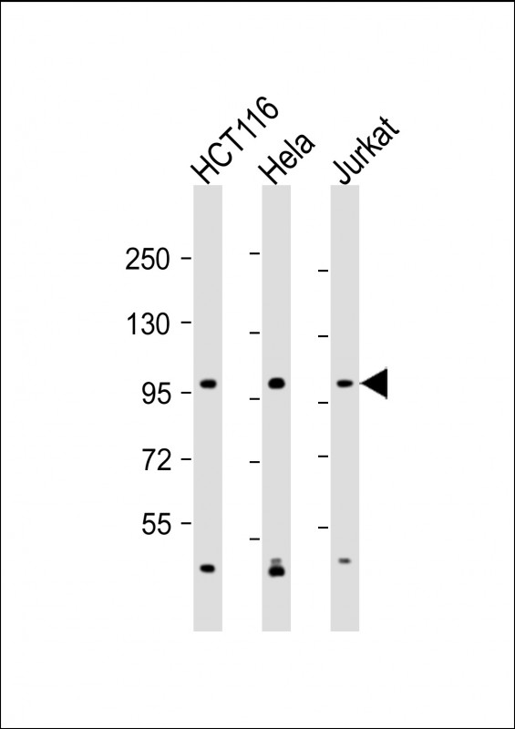 Rabbit Polyclonal Antibody to MANBA