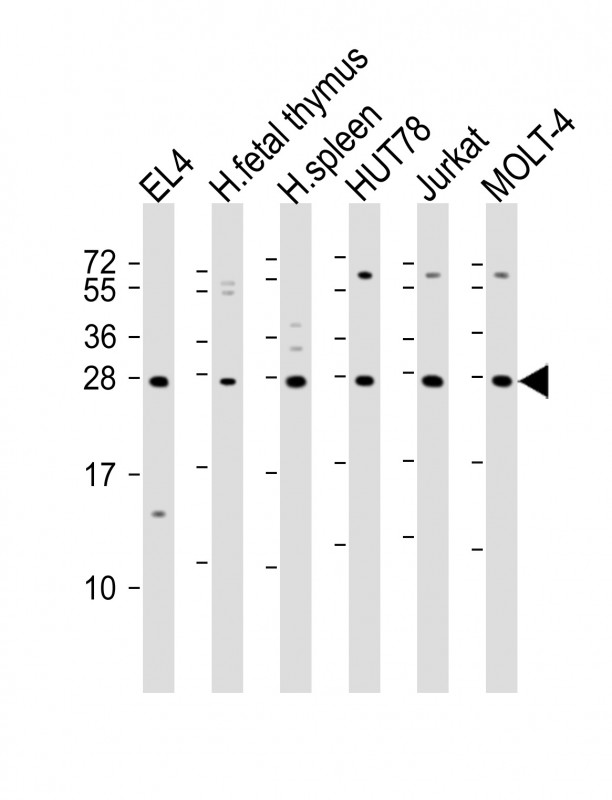 Rabbit Polyclonal Antibody to TIGIT