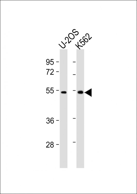 Rabbit Polyclonal Antibody to CHTF8