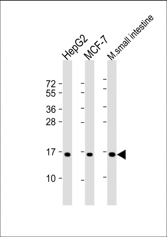 Rabbit Polyclonal Antibody to COXIV Isoform 2
