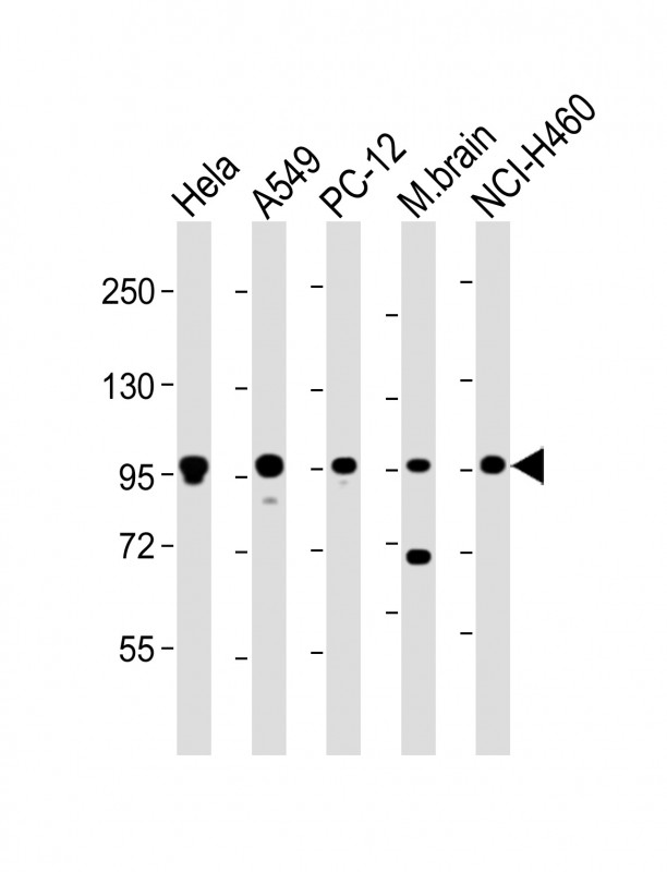 Rabbit Polyclonal Antibody to PCSK1