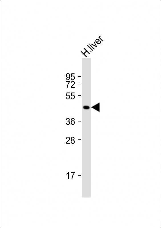Rabbit Polyclonal Antibody to GCNT2