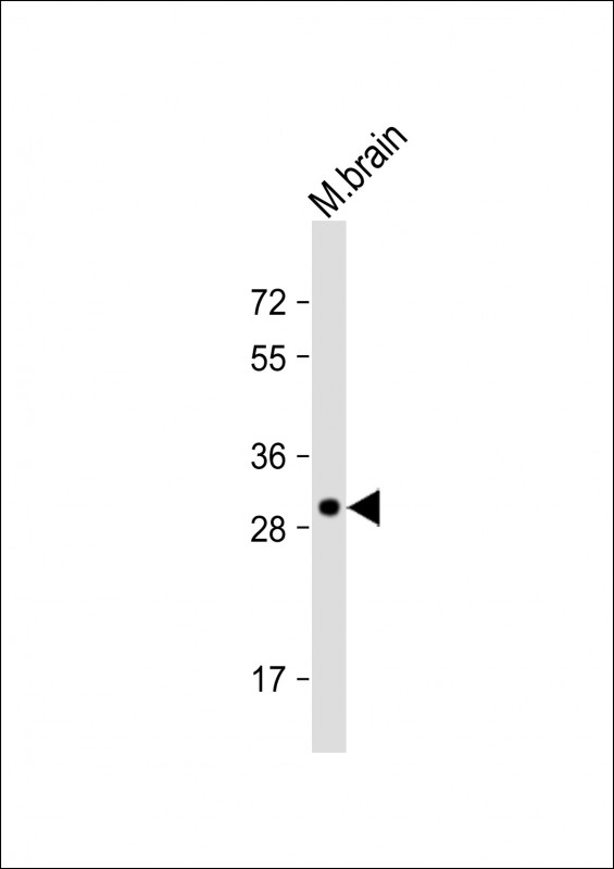 Rabbit Polyclonal Antibody to Dtnbp1