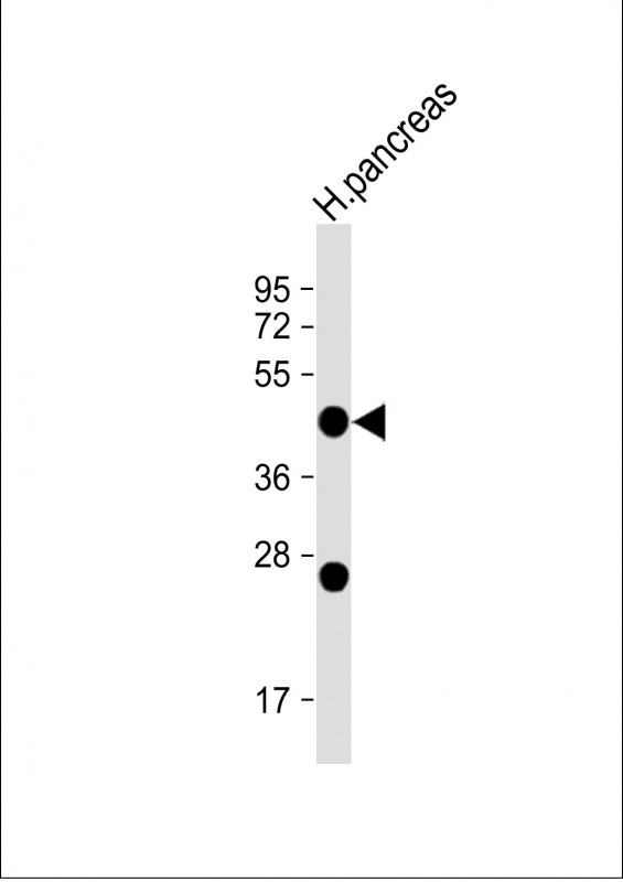 Rabbit Polyclonal Antibody to NPTX2