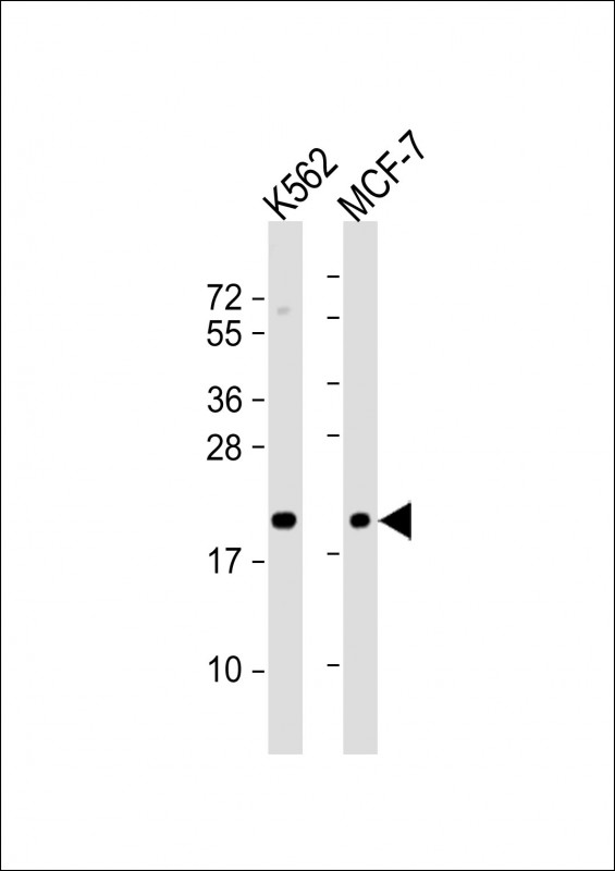 Rabbit Polyclonal Antibody to APRT